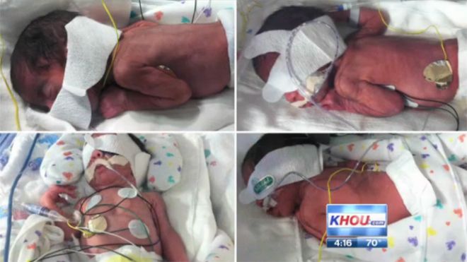 Two-Sets-of-Twins_KHOU-in-Houston