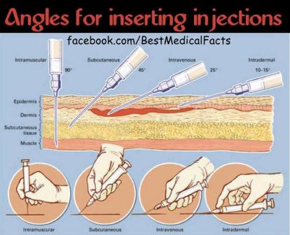 injection-angles