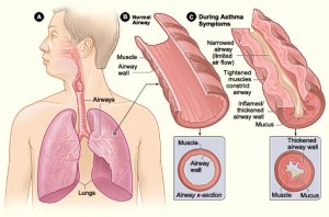 lung-system