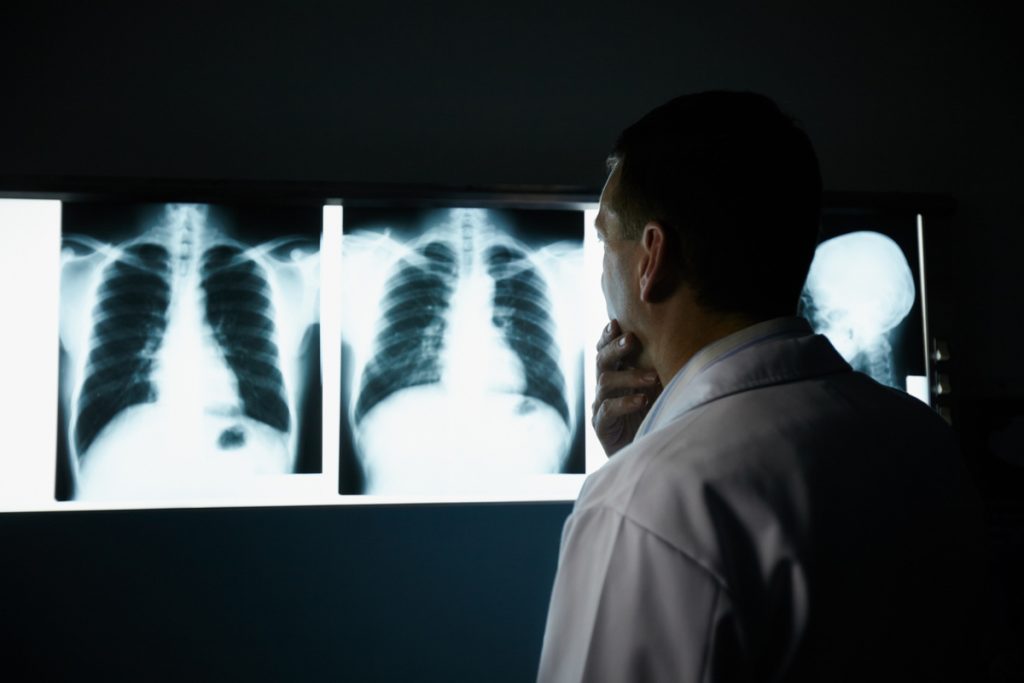 Become a Radiologist in India
